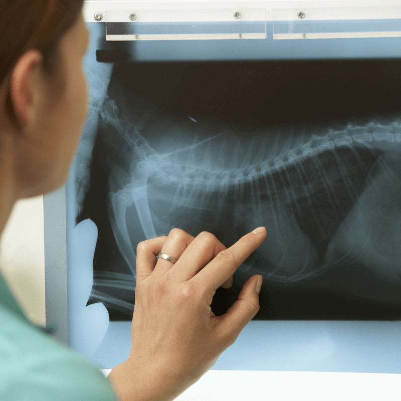 A person pointing at x-ray